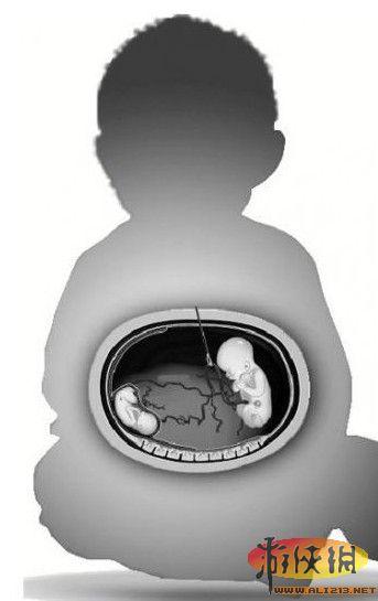 代生出的孩子像谁【代生出的孩子像谁：寻找生物学家的基因融合之谜】